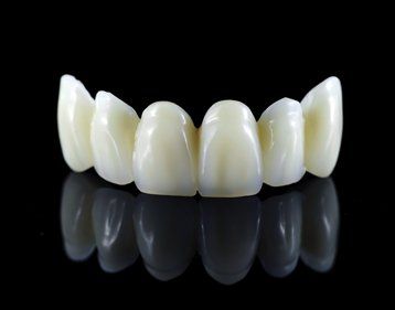 Dental bridge prosthesis on a black reflective surface, showcasing artificial teeth.