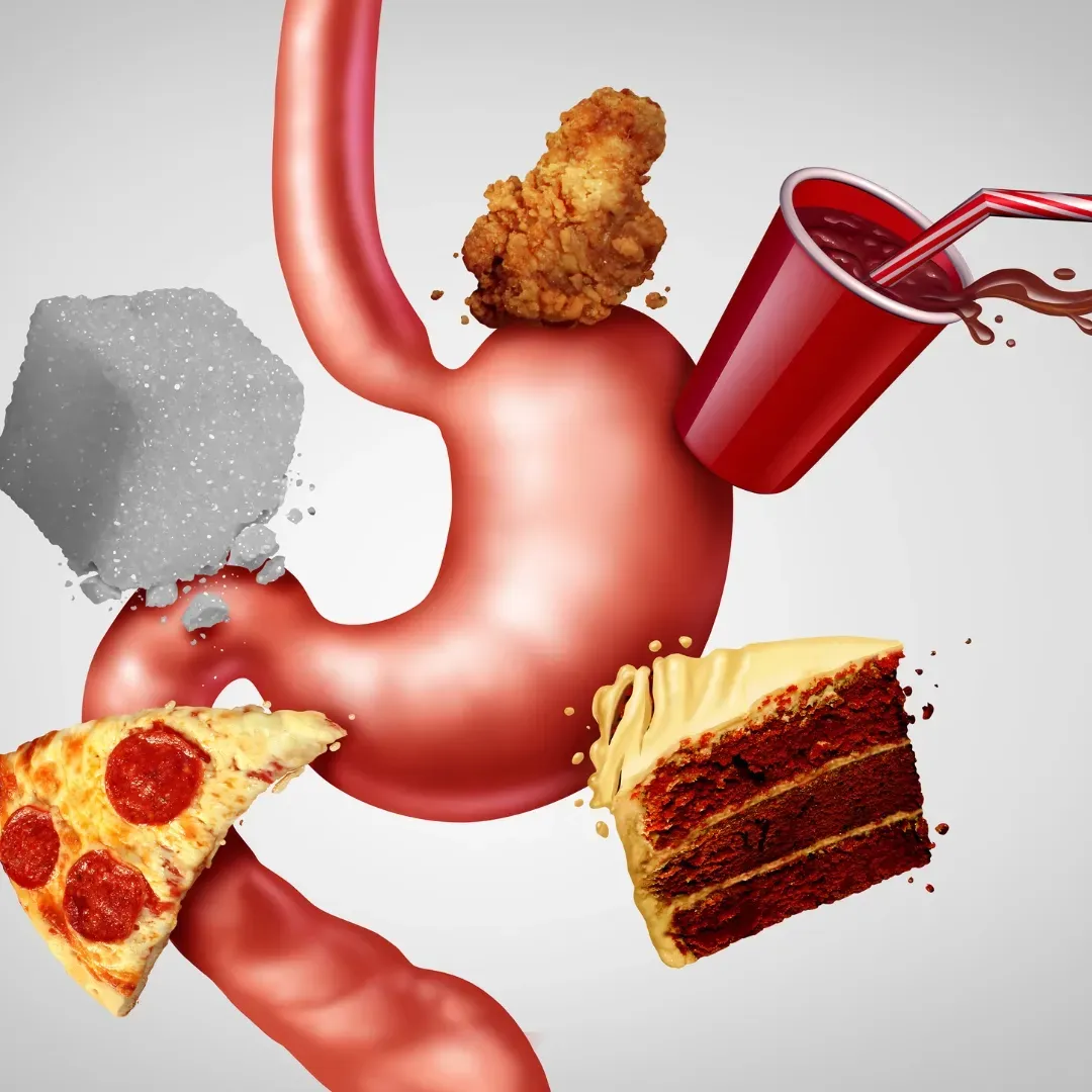 How to Stop Your Food Cravings With Hypnotherapy