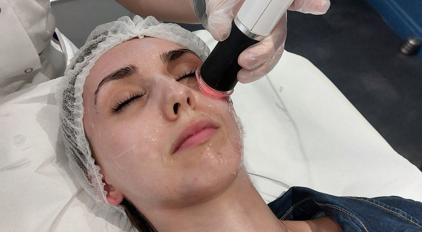 Peeling visage tours Nov'esthetic