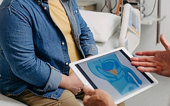 DISFUNZIONE ERETTILE