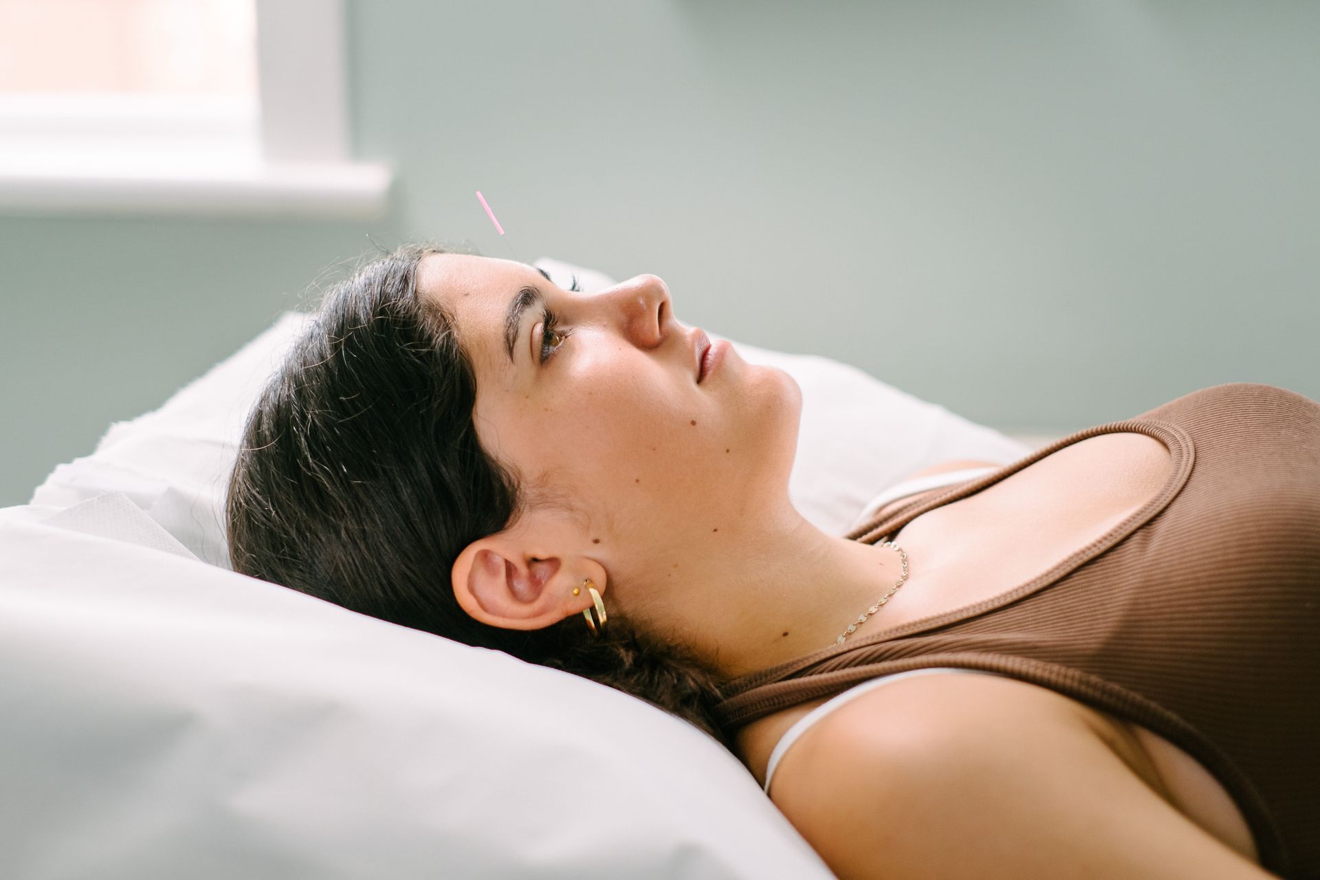 Woman receiving acupuncture, lying on a white bed, wearing a brown top.