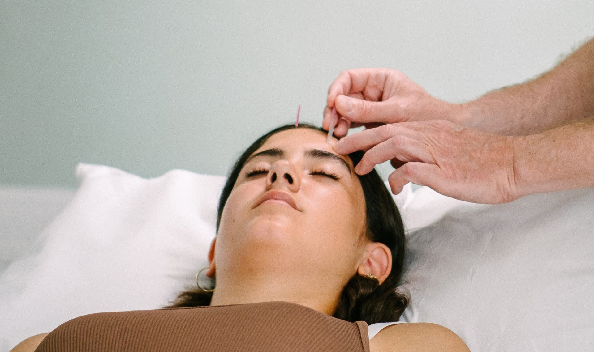 A female acupuncture patient,  deeply relaxed on the couch, with an acupuncturist placing a needle on her forehead.