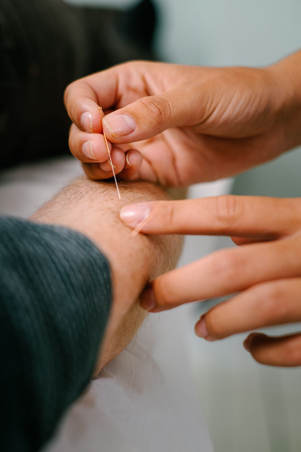 Hands inserting an acupuncture needle into a person's wrist.