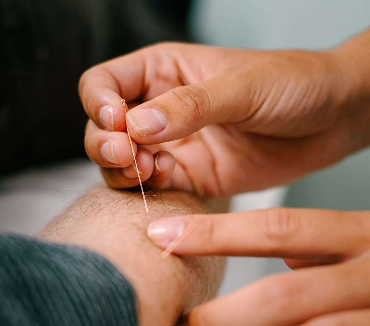 Hands holding and inserting an acupuncture needle into a person's arm.