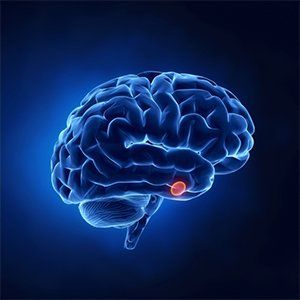 3D image of brain — Diabetic Care in Denton TX