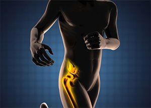 3D image of bones — Diabetic Care in Denton TX