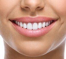 White Teeth and Beautiful Smile — Teeth Cleanings in Deerfield Beach, Fl