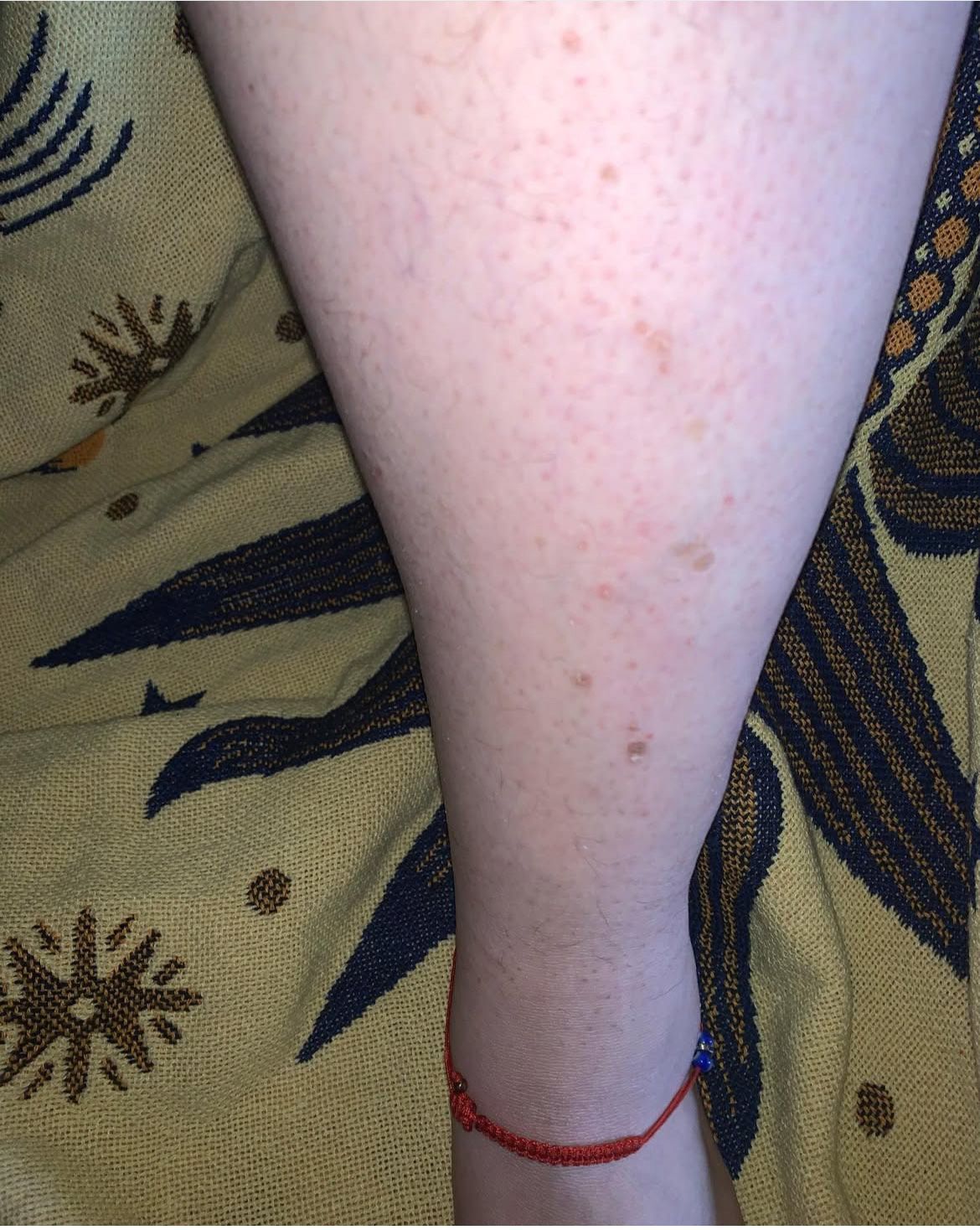 A woman 's leg with a red bracelet on it