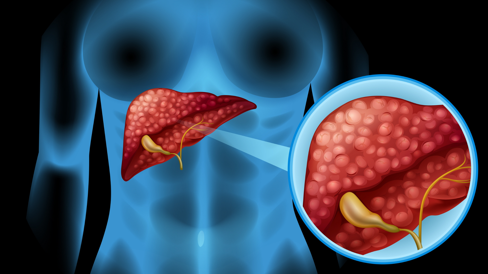 A group of viruses with female symbols on them are floating on a red background.