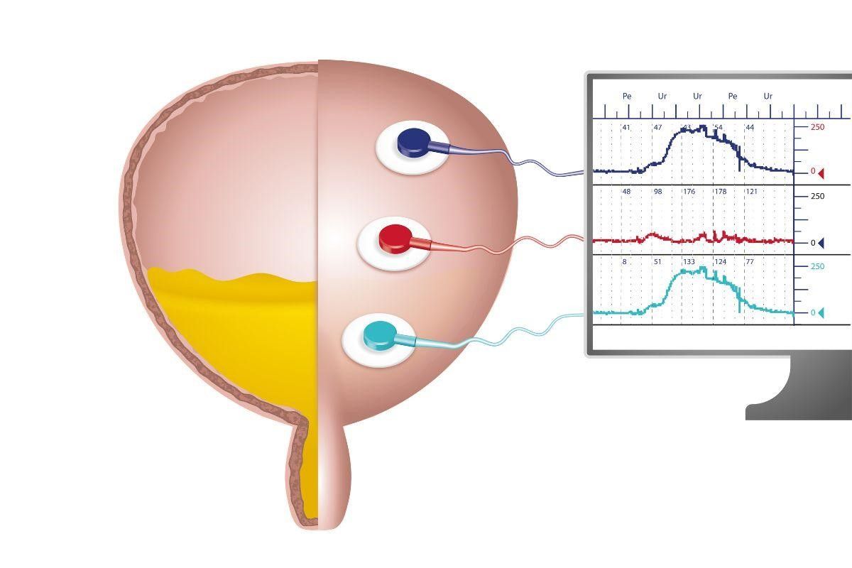 como-funciona-estudo-urodinamico-teresina-dr-antonio-rocha-junior-urologista-teresina-piaui