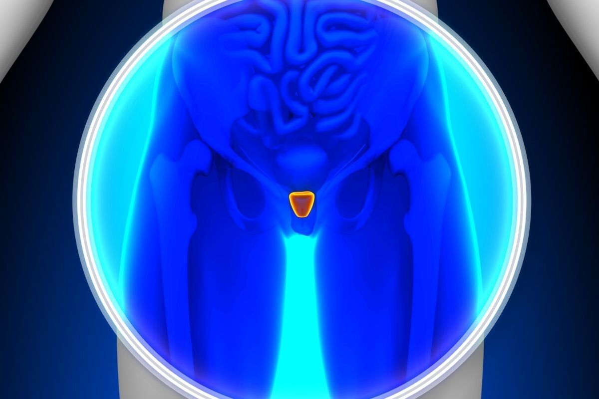 prostata-aumentada-dr-antonio-rocha-junior-urologista-teresina