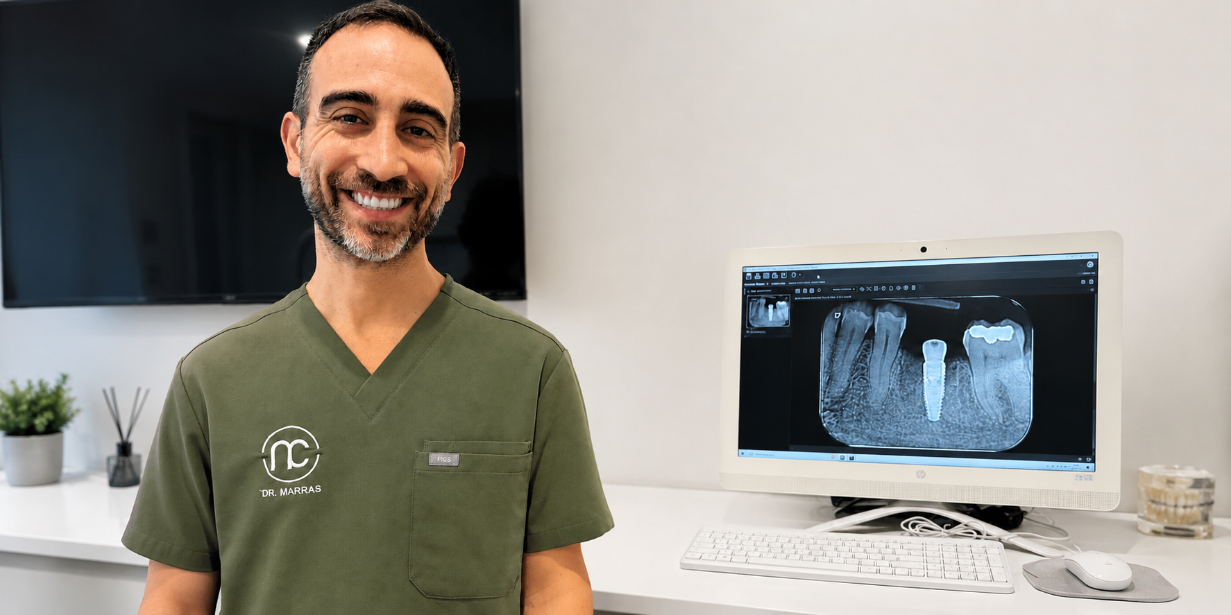 Quanto durano gli impianti dentali e come prendersene cura