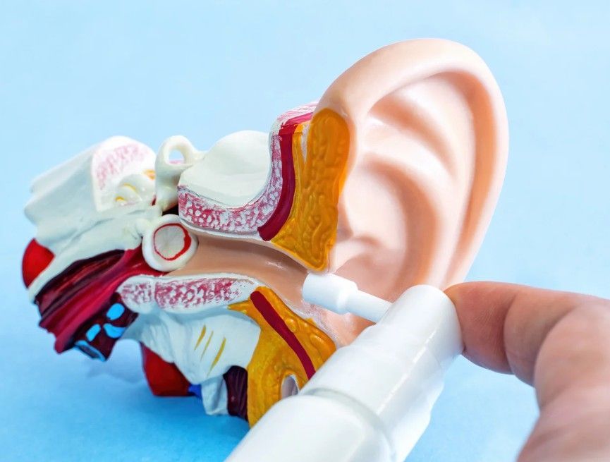 demonstrating on a model how to apply olive oil spray prior to ear wax removal in Coventry