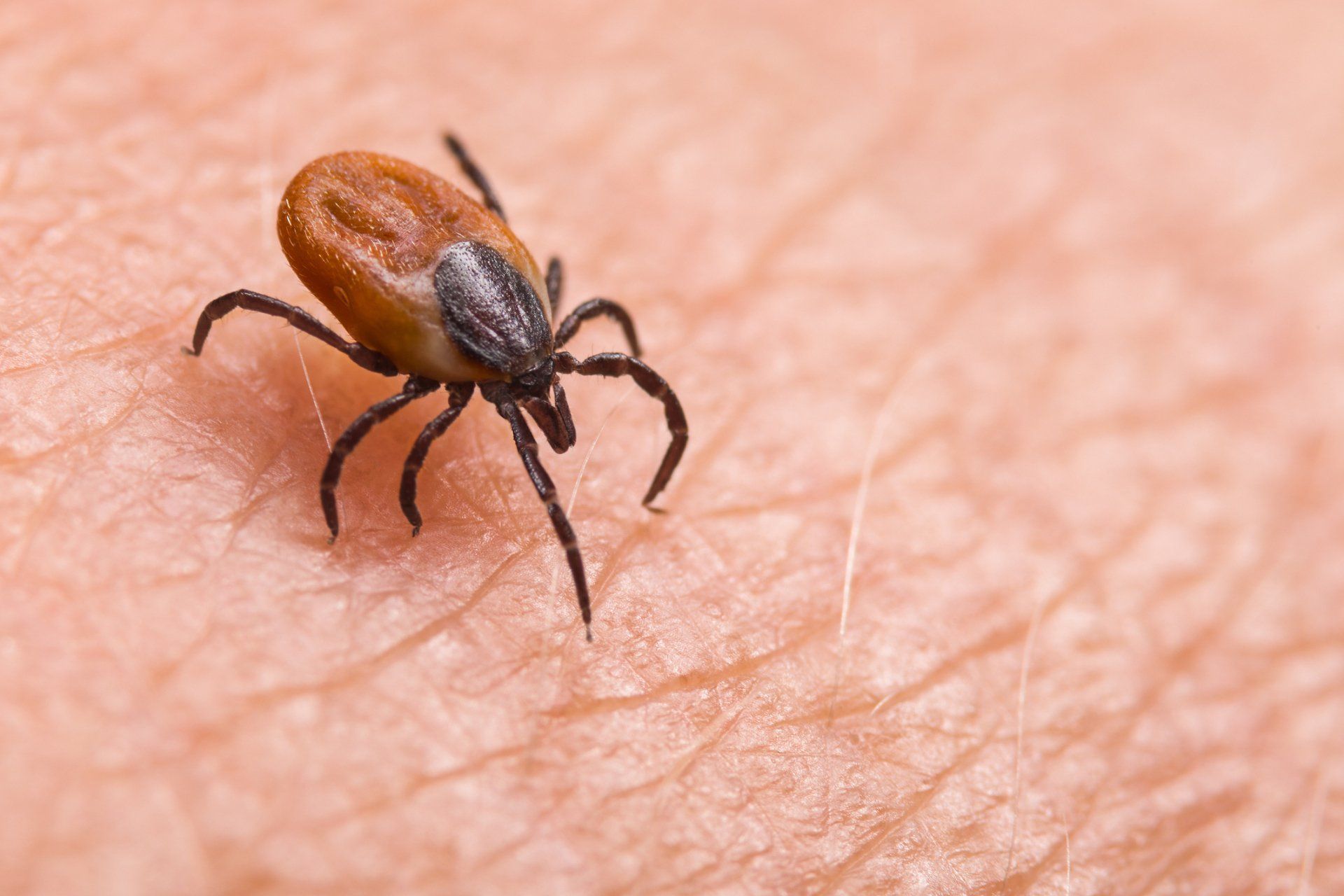 Tick On Hairy Human Skin — Highland Park, IL — A-1 Pest Control