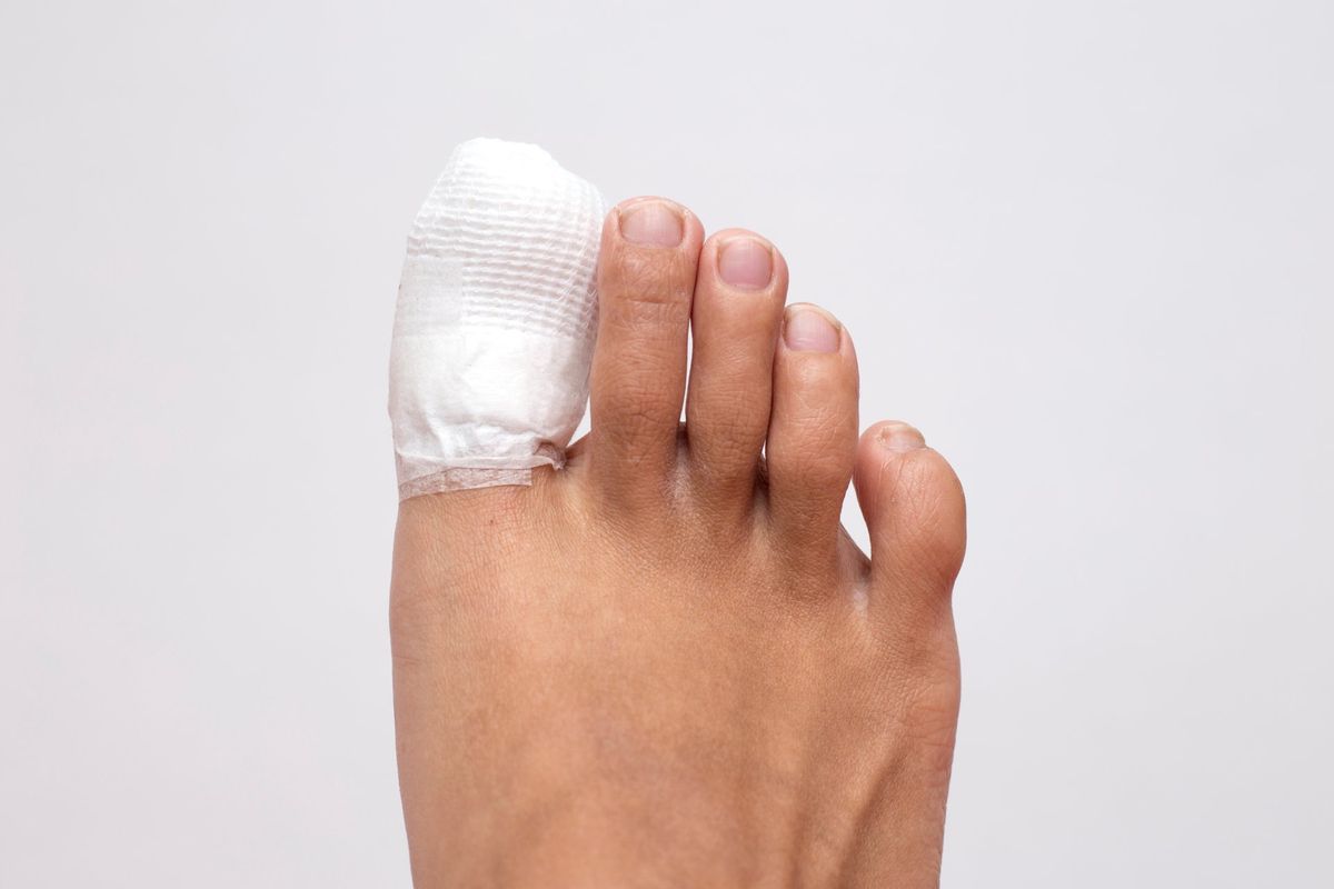 treatment available for ingrowing toenails