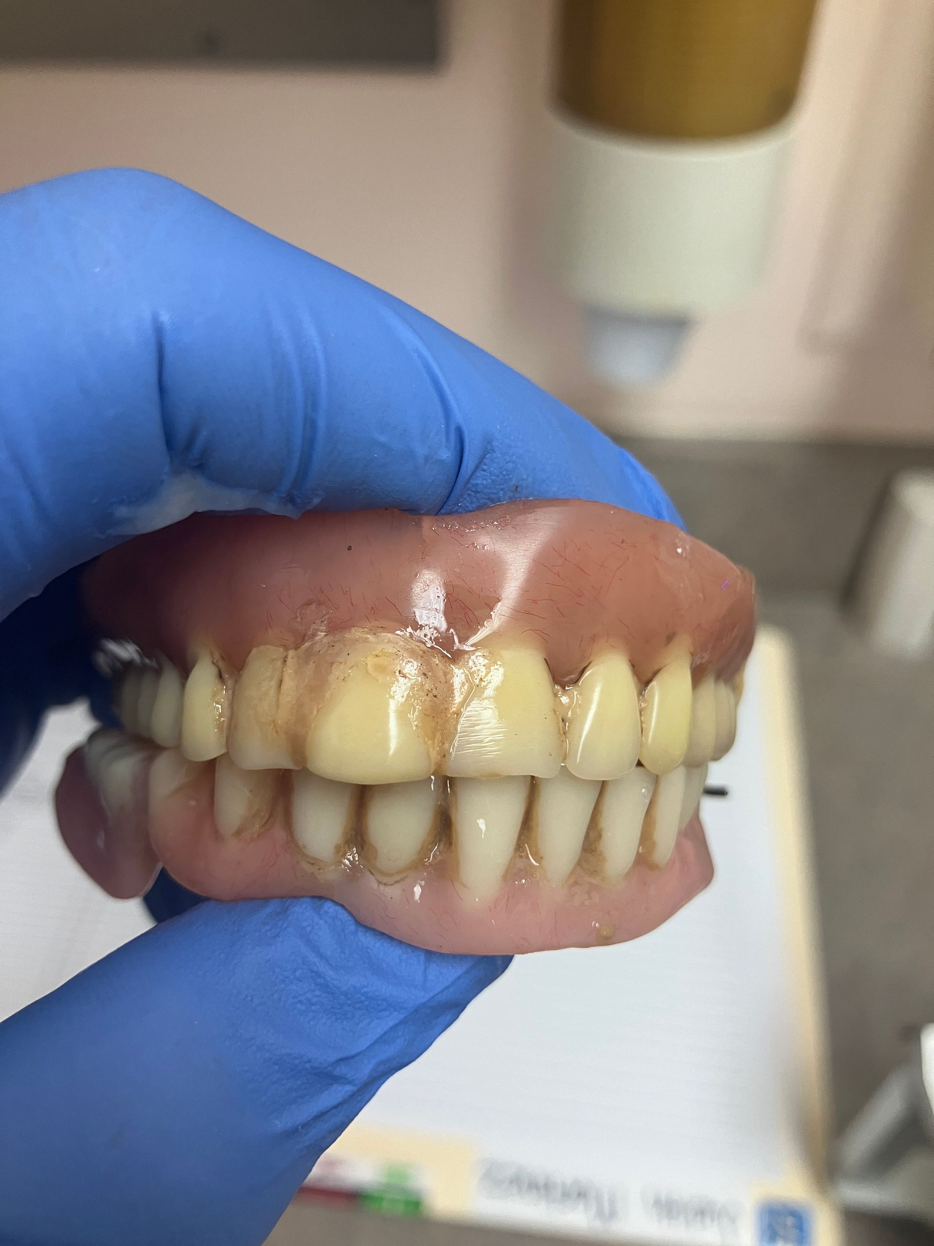 A person wearing blue gloves is holding a denture in their hand.