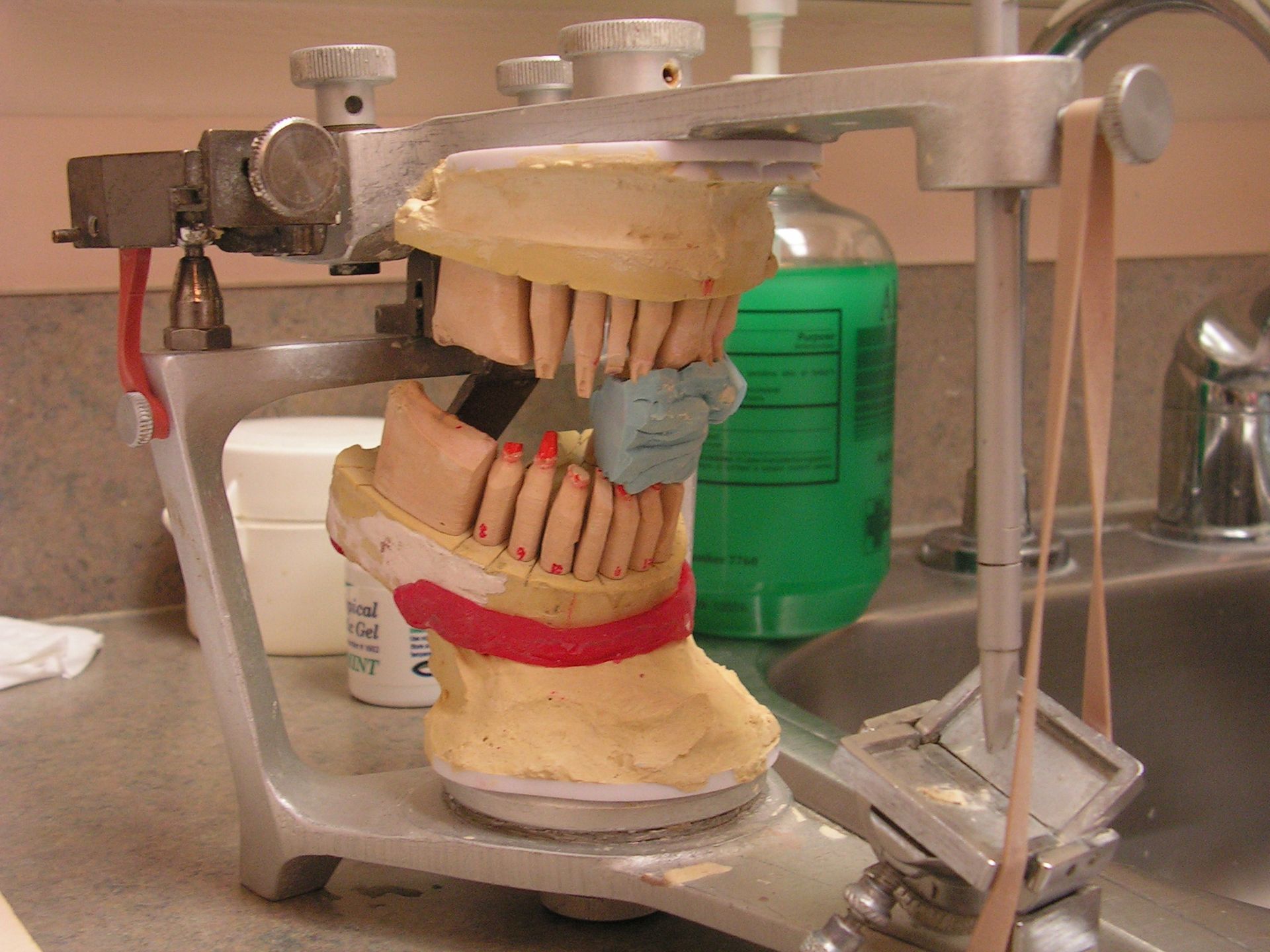 articulated models for implant reconstruction full mouth, top dentist riverview, dentist 33578