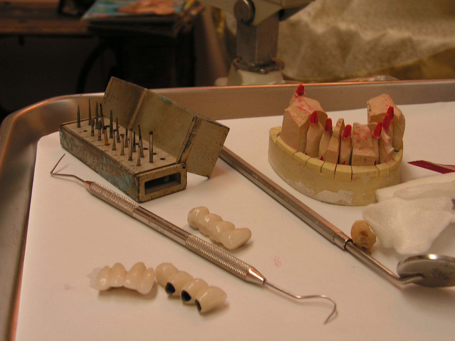 implant dental restorations, dentist 33578, best dentist riverview, top dentist 33578, dental implant reconstruction
