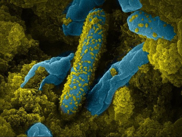 Oral bacteria from gum disease traveling to the heart causing endocarditis — Dr. Castellano DMD Rive