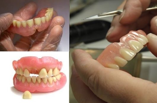 denture/flase teeth  repair  in Riverview fl