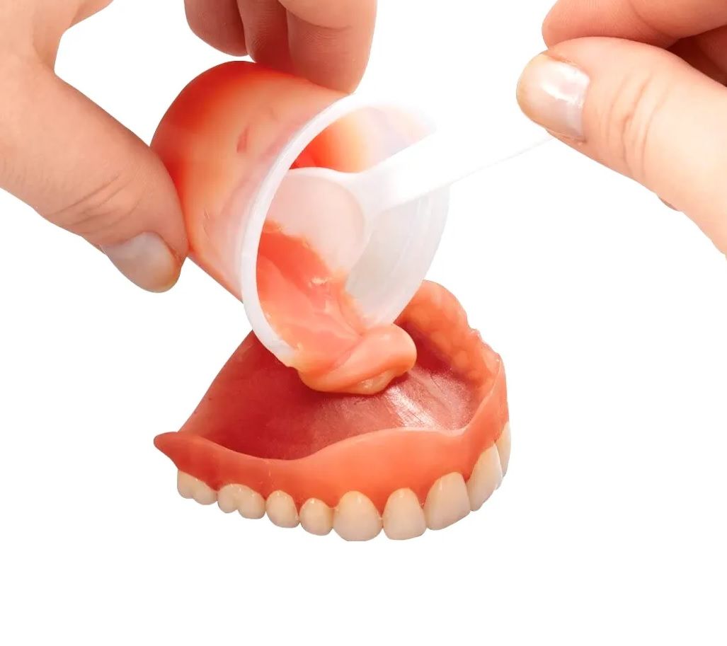 same day temporary soft denture relines in review for tight fit. 