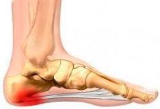 Illustration showing foot pain area