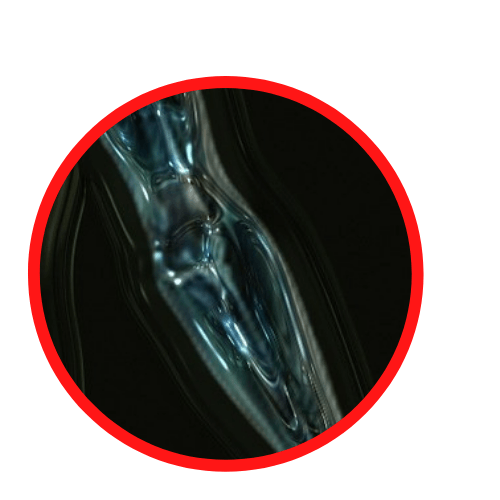 Elbow