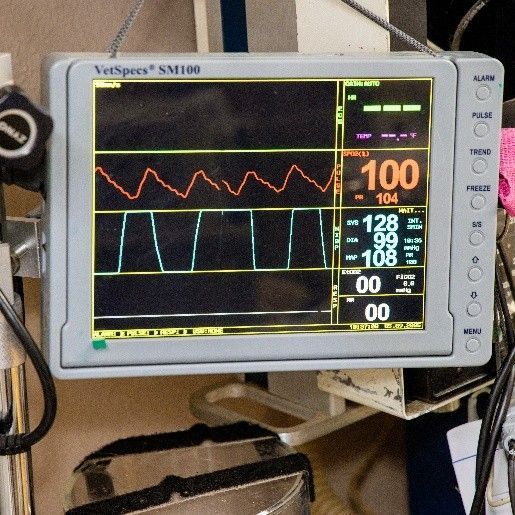 A monitor with the number 100 on it