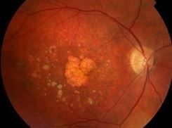 SCOTS Eye Stem Cell Study Exceeds Research Goals