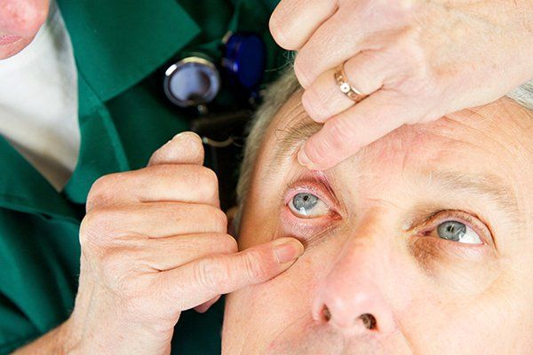 Contact Lens — Tonawanda, NY — Eyesight Medical Center