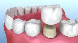 Dental Hygiene Dental Hygiene