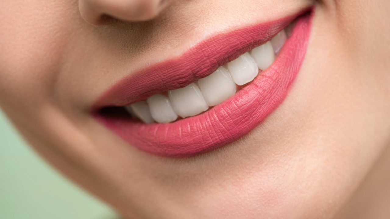 a woman flaunting her smile after getting dental bonding