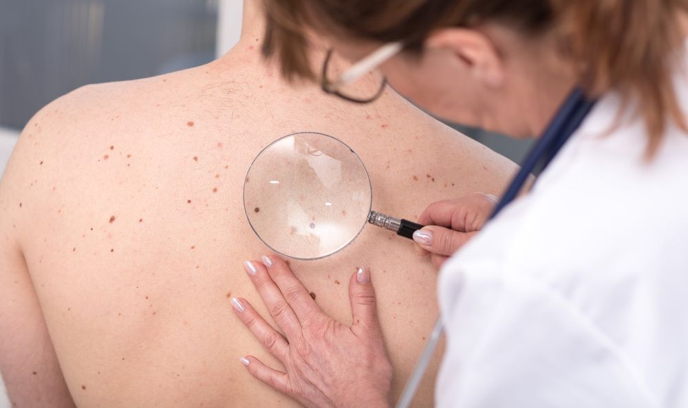 A Doctor is Examining the Patient Back With a Magnifying Glass — Coastal Skin & Laser in Caloundra, QLD