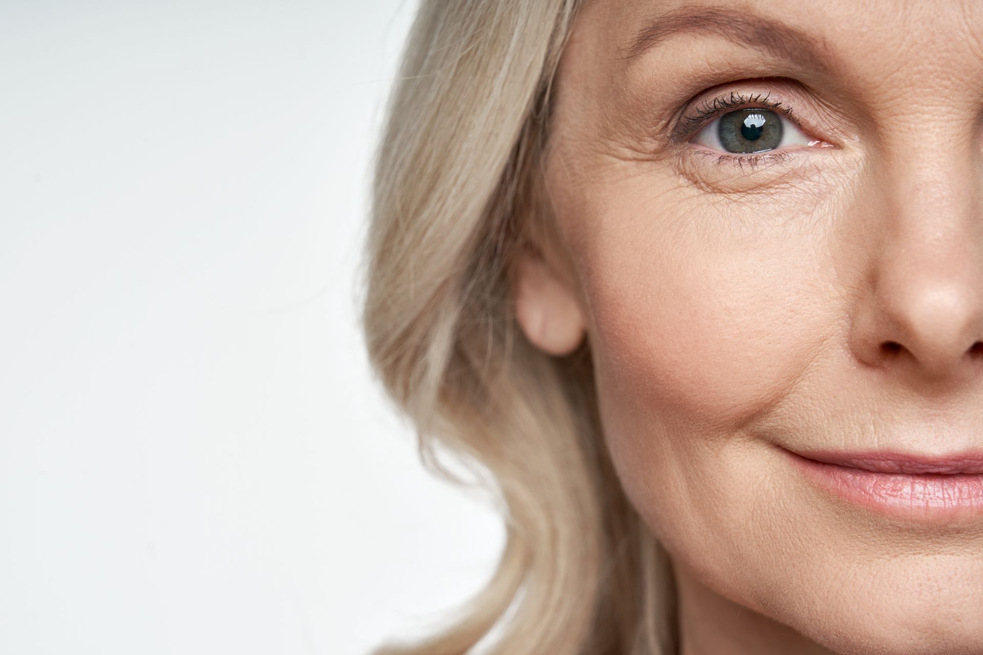 Close-up of a Person's Face; Fair Skin, Blonde Wavy Hair, Smiling, Visible Wrinkles — Coastal Skin & Laser in Tewantin, QLD 