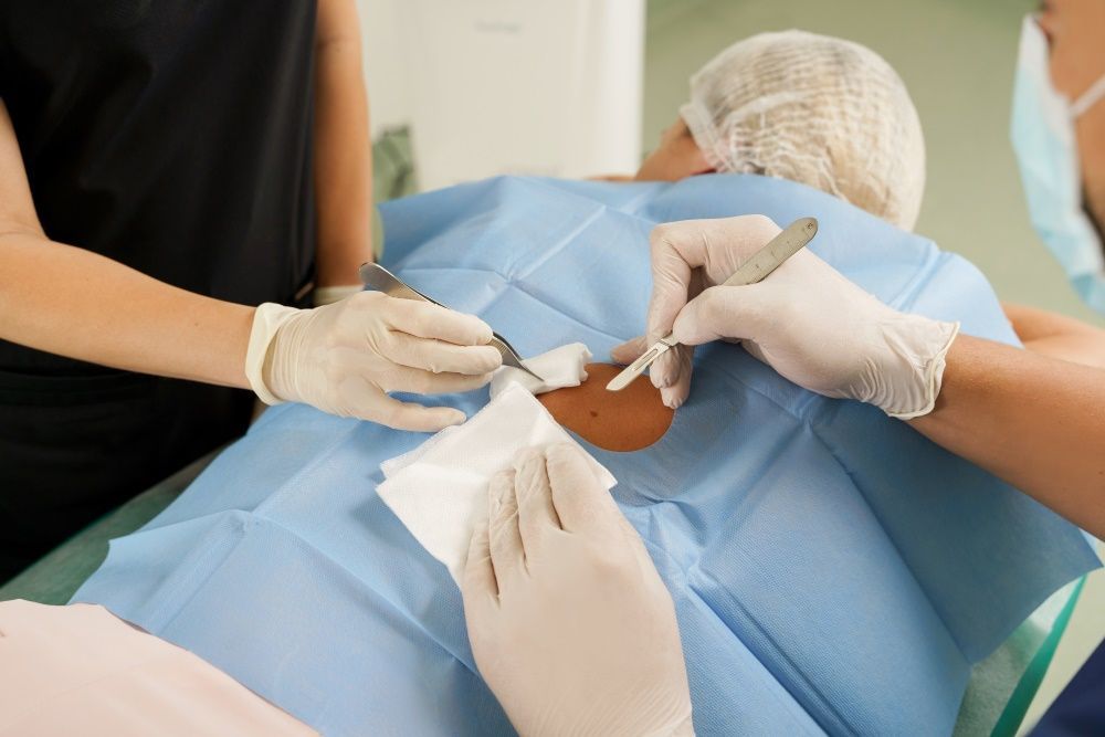 A Person is Laying on a Table Being Operated on by Two Surgeons — Coastal Skin & Laser in Tewantin, QLD