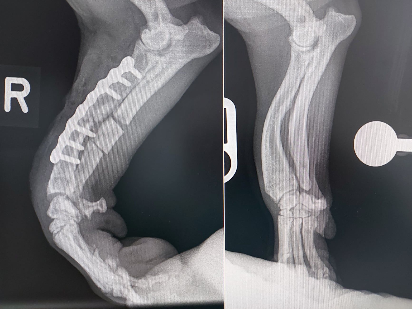 Radiography - Angular Limb Growth Deformity