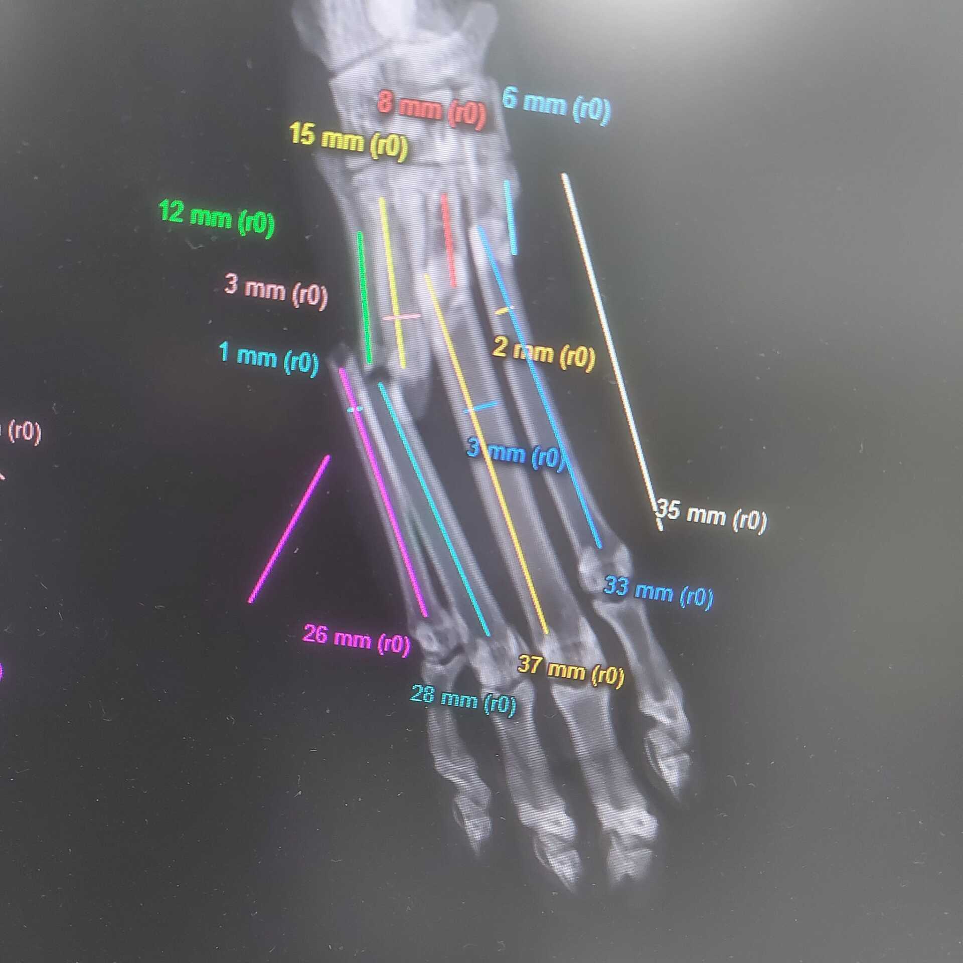 Metatarsal fractures in a cat (1)
