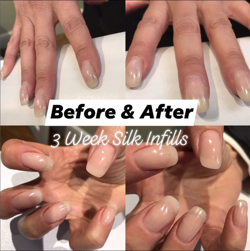 Before-After-Silk-Nail-Infills