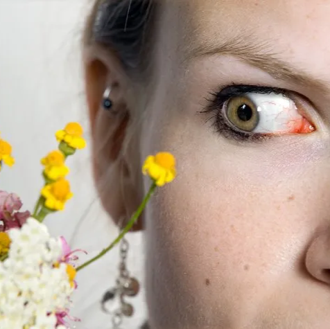 Woman with red irritated eye looking at flower arrangement