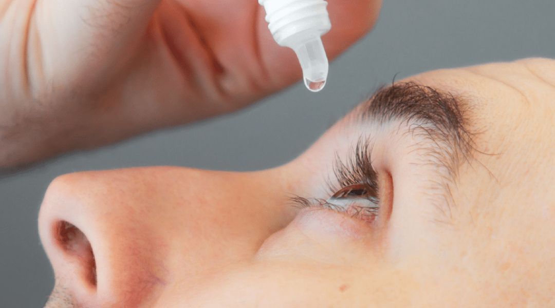 Closeup of a person putting eyedrops in their eyes.