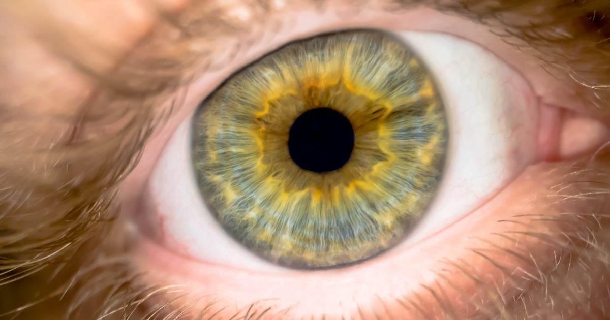 A close up of a person's green and yellow eye.