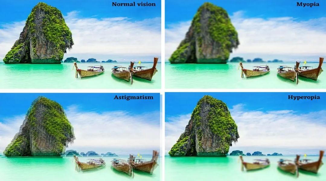 4 examples of boats in water when viewed with Normal, Myopia, Hyperopia, & Astigmatism vision