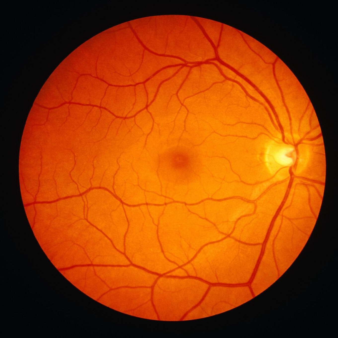 Digital retinal imaging