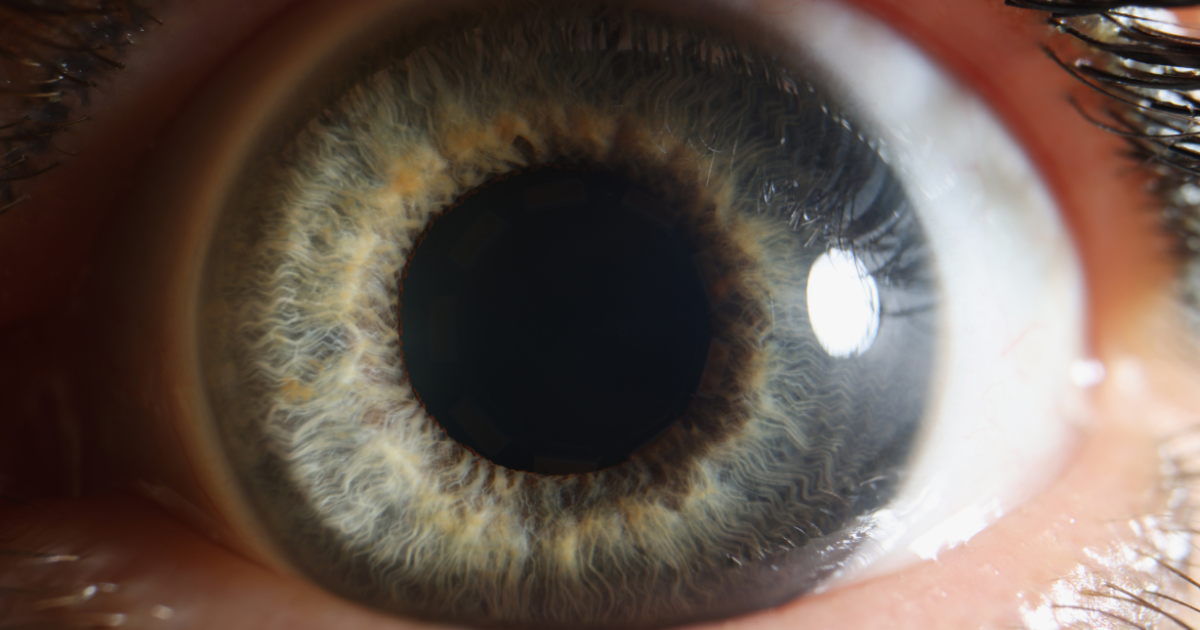  A closeup of a dilated pupil