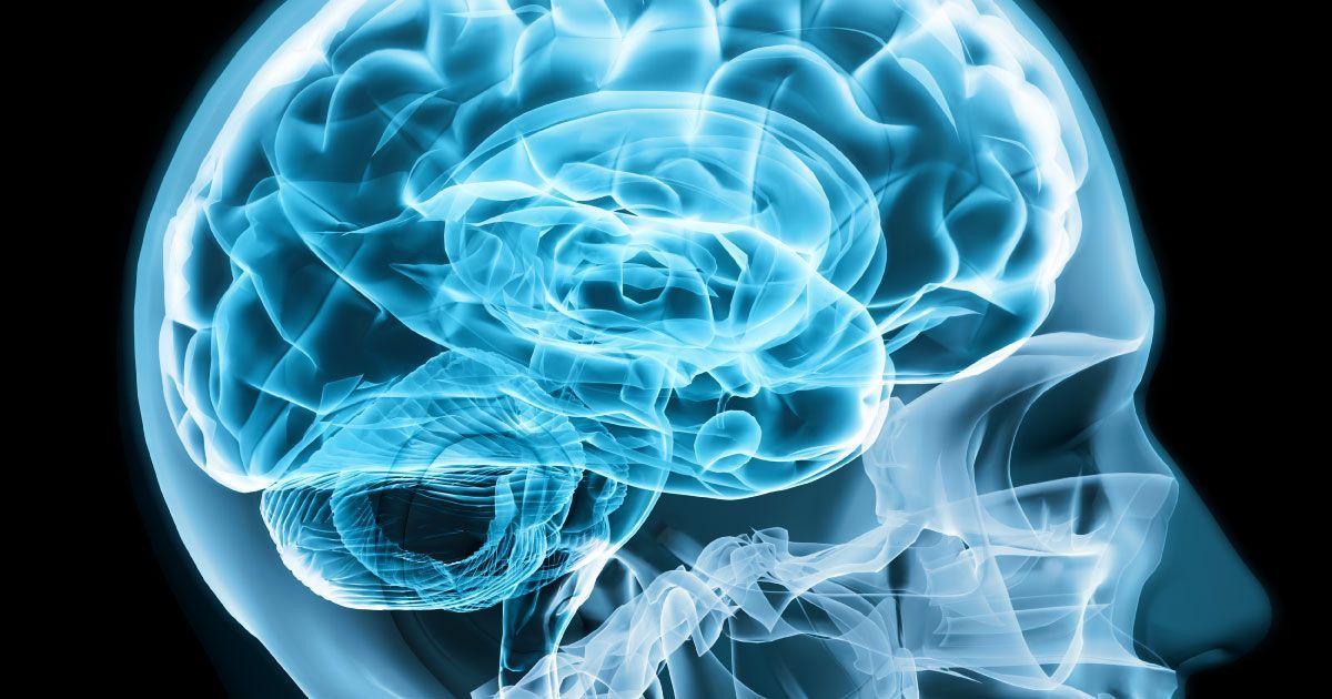 An x-ray of a person's brain and skull.