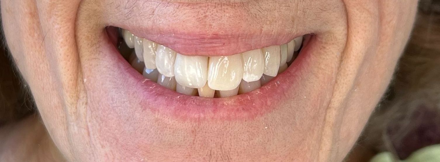 A close up of a person 's mouth with a smile on it.