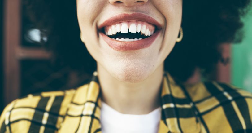 A close up of a woman 's mouth with her teeth showing.