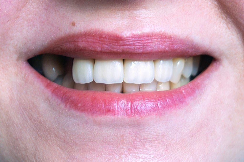 A close up of a woman 's mouth with white teeth and red lips.