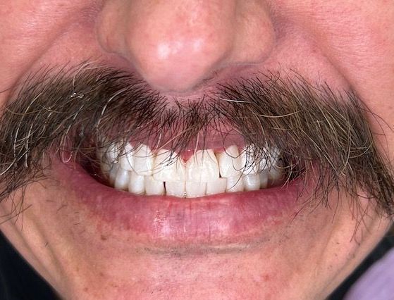 A man with a mustache and white teeth is smiling.