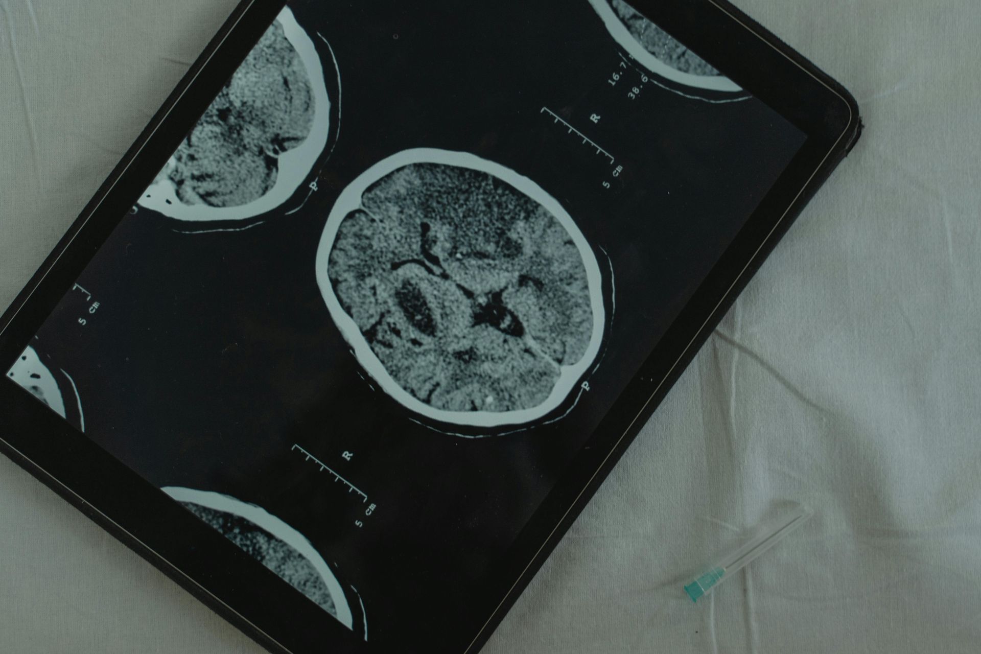 A tablet with a picture of a brain on it.